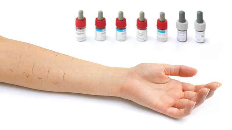 Homeopatía en Andorra para los síntomas de las alergias