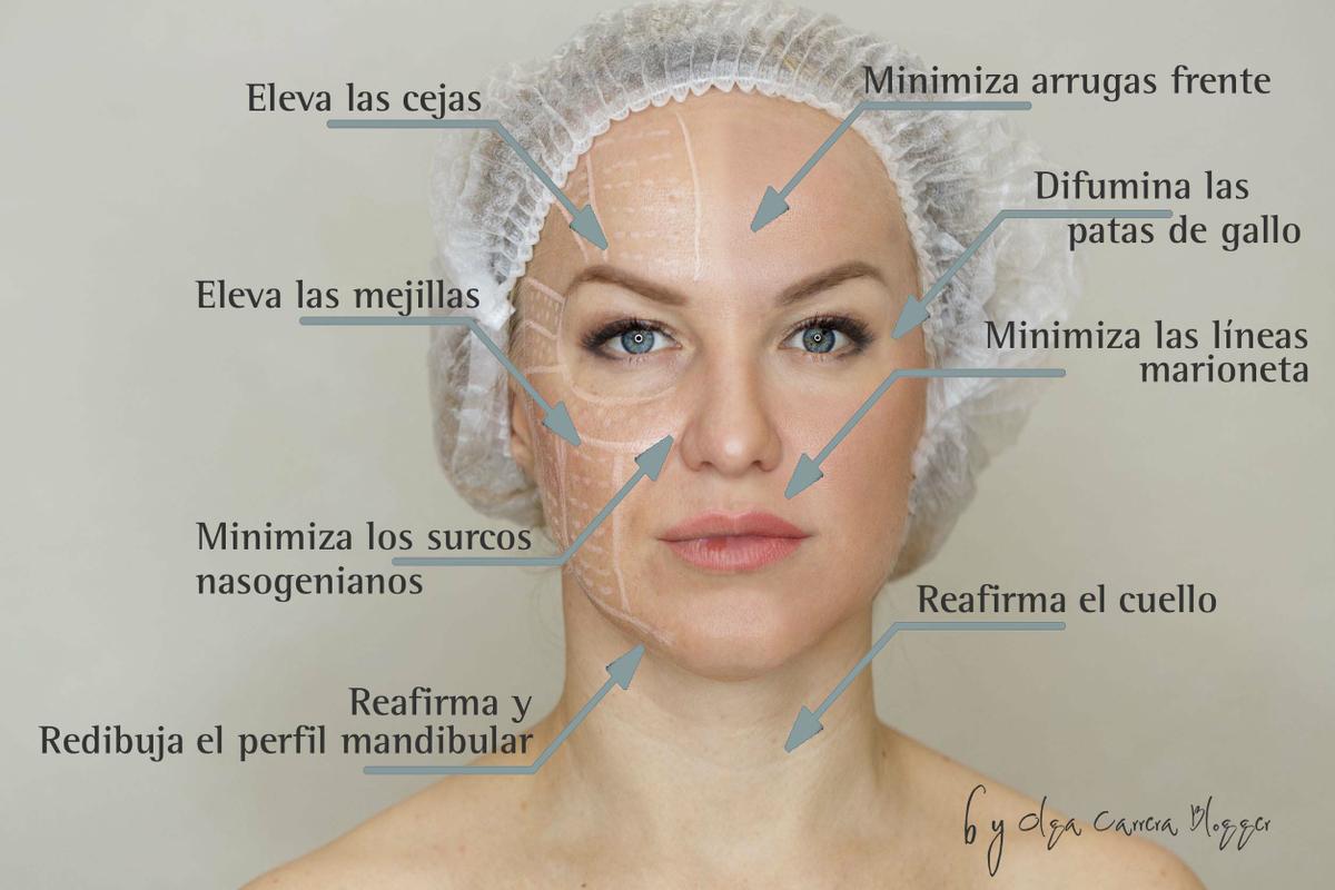 hilos tensores o hilos mágicos por Olga Carrera Blogger Madrid