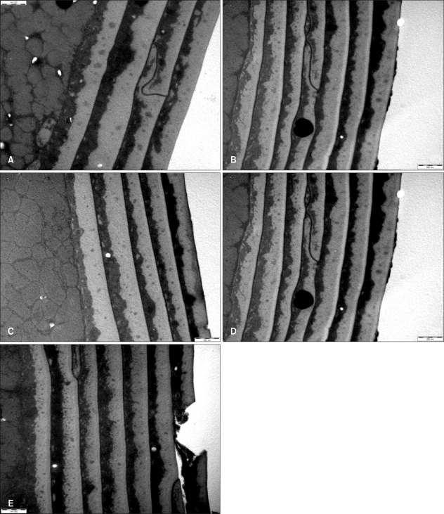 cuticula-secador-pelo-capa-externa-daño