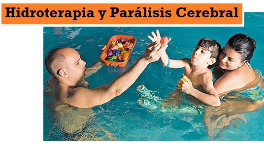 Hidroterapia y Paralisis Cerebral