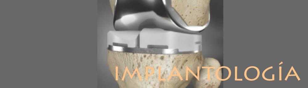 Impresión de implantes