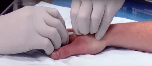 chips en seres humanos