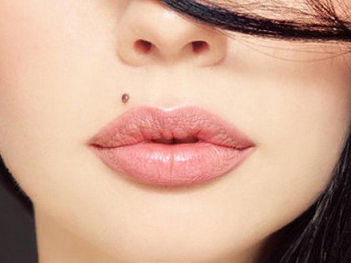 Las verrugas y los lunares: ¿Que son?