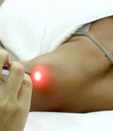 La acupuntura se basa más en la comprensión de la anatomía