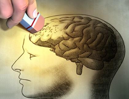 Alzheimer: Signos y síntomas 