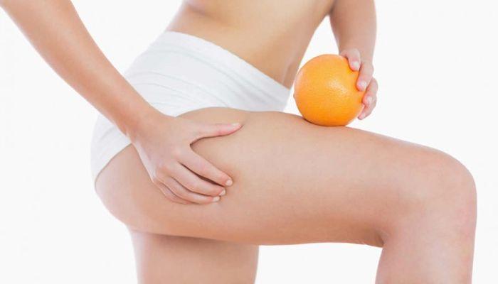 remdios para la celulitis