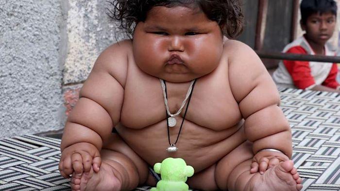 niños gordos
