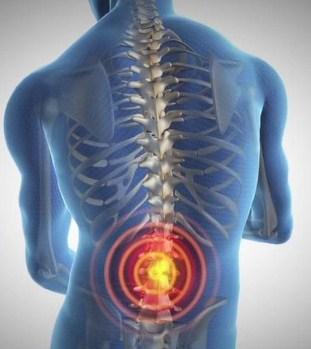 los pacientes con espondilolisis no presentan síntomas evidentes