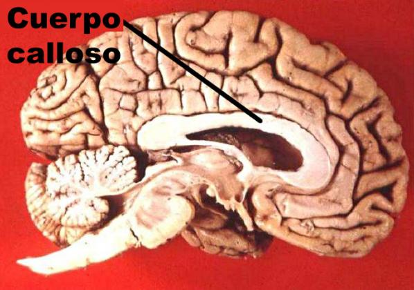 cuerpo calloso