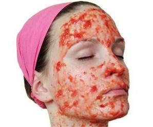 Remedios caseros con tomates