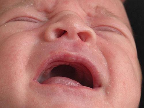 PALADAR OJIVAL Y LACTANCIA