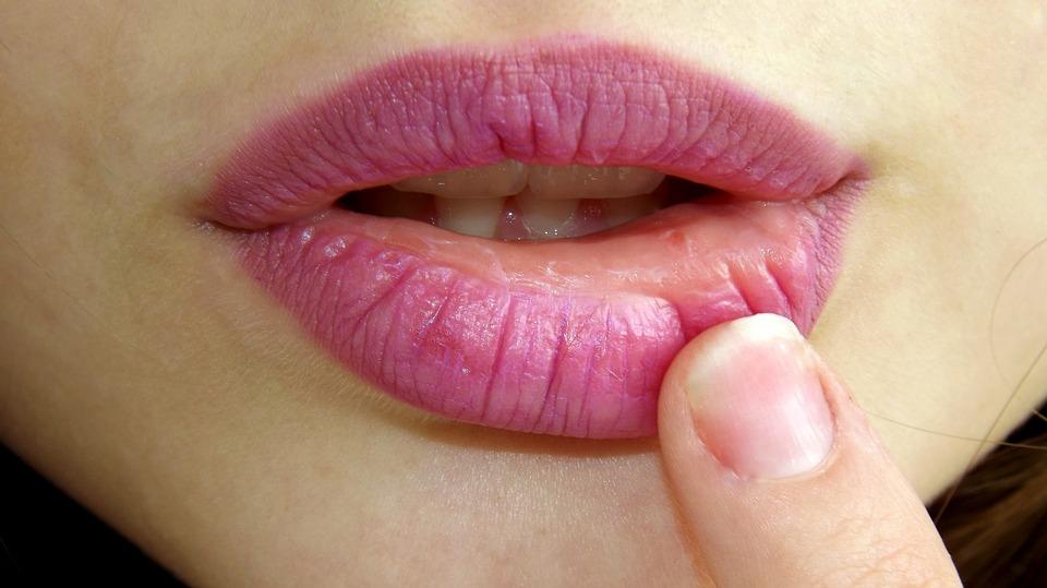 tratamiento natural para el herpes labial