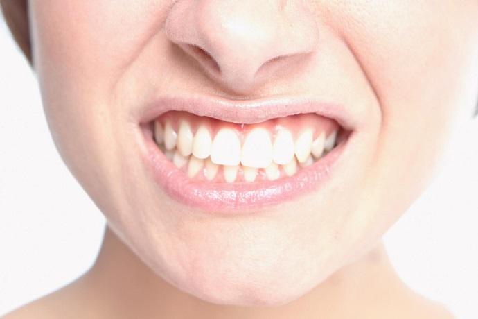 clinica-dental-aviles-centro-dental-innova-endodoncia-bruxismo-dental