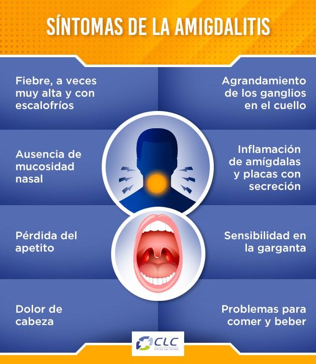 Resultado de imagen de infografia garganta