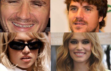 diastema antes y después