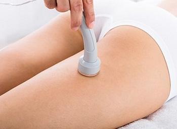 tratamiento para estrias rojas microdermabrasion