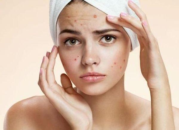 7 tips para mantener tu rostro sin mancha