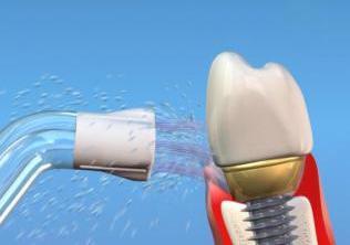 irrigador dental para implantes