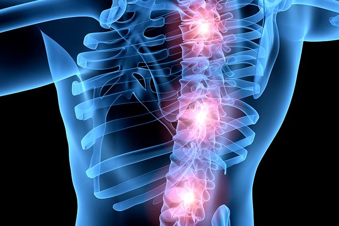 Traumatismo de la columna vertebral