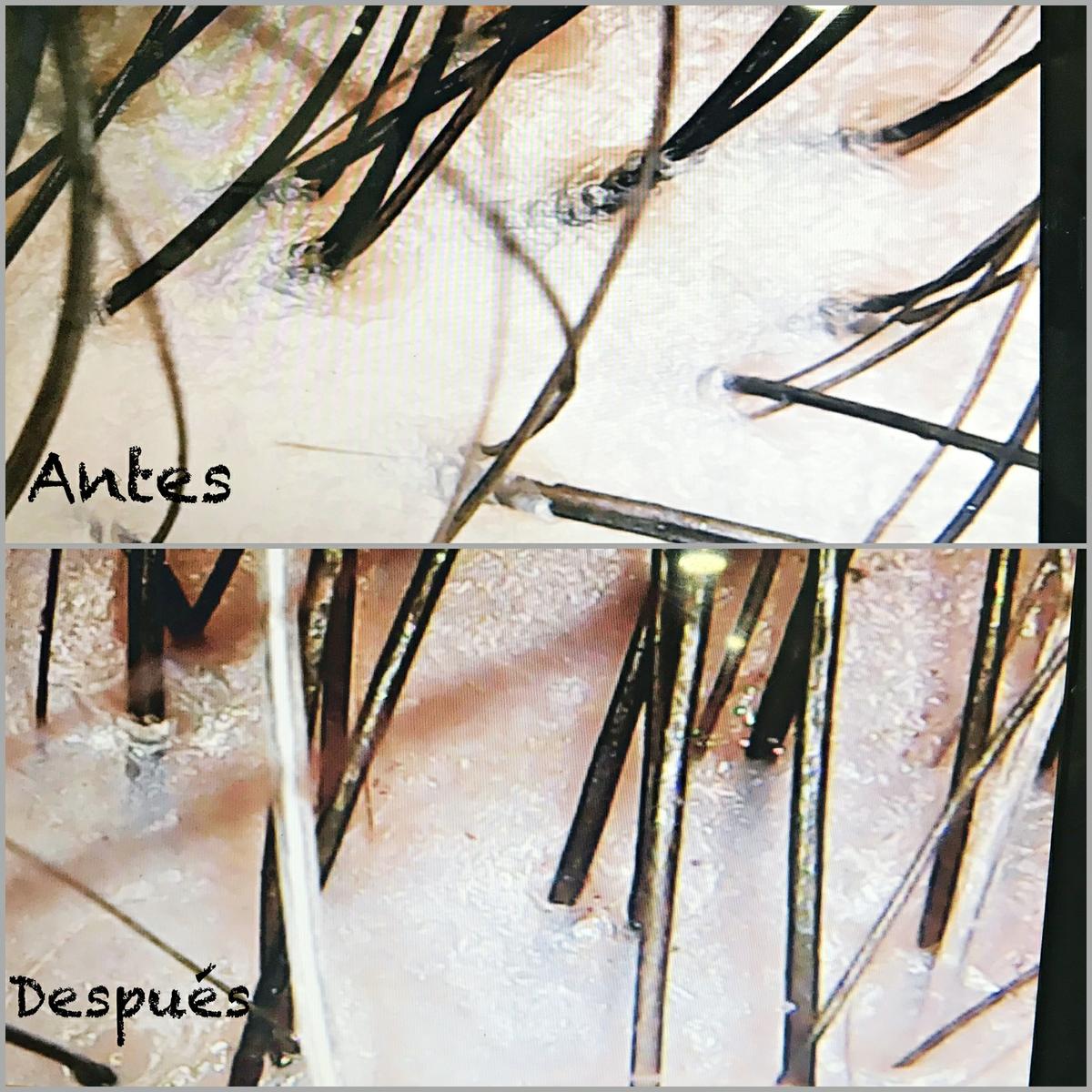Antes y despues oxigenación 1