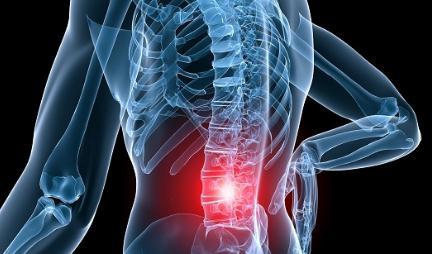 el dolor es un sintoma de la inestabilidad lumbar