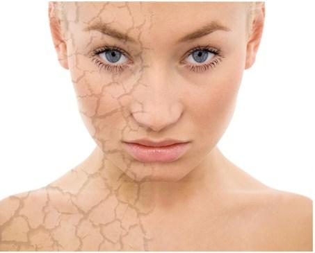 Inconvemientes de la piel reseca