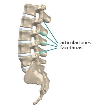 artrosis facetaria conjunta