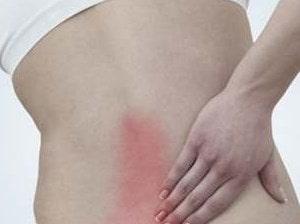 Los síntomas de la artrosis facetaria varían