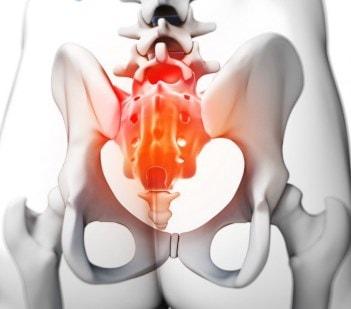 La coxidinia se origina cuando el coxis ha sufrido algún daño