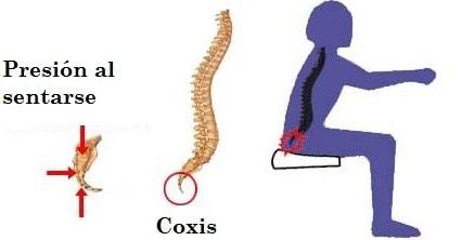 debemos mantener una postura consciente para evitar la coxidinia