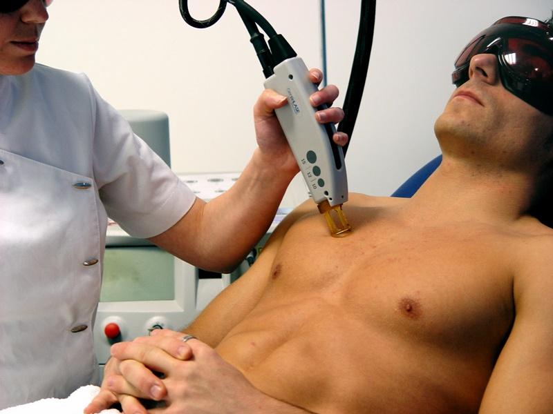 Depilación masculina