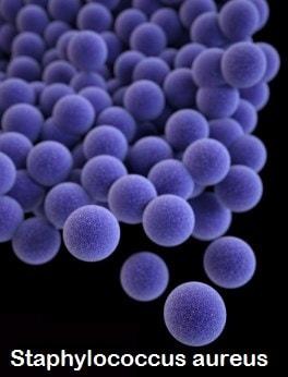 La osteomielitis es causada por una bacteria llamada Staphylococcus aureus
