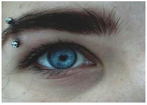 Causas de los párpados caídos