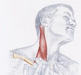 Este ejercicio alarga el músculo esternocleidomastoideo