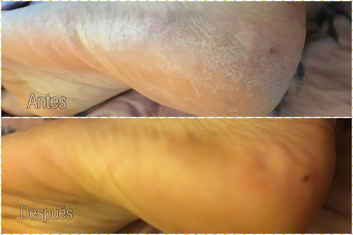 lima-electrica-tus-pies-siempre-listos