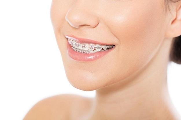 ortodoncia-clinica dental aviles-centro dental innova