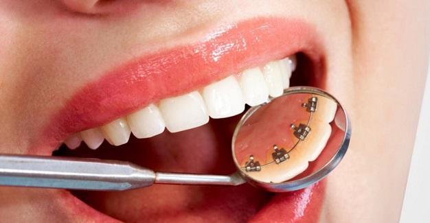 ortodoncia-clinica dental aviles-centro dental innova