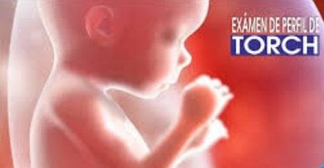 Se deben realizar los exámenes preventivos para la microcefalia, como el perfil TORCH