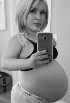 La hipocondroplasia no es impedimento para el embarazo