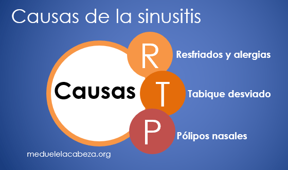 causas de la sinusitis