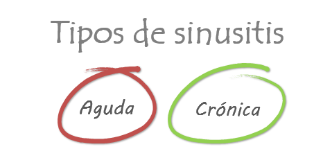 tipos de sinusitis