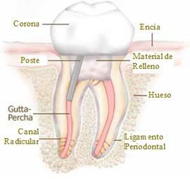 Restauracion-del-diente