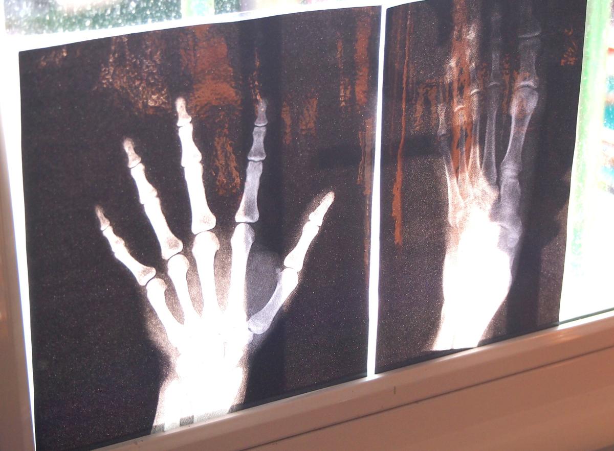 Radiografia imprimida y plastificada en la ventana