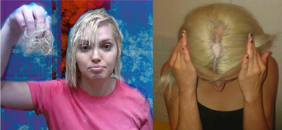1. "Bleaching Gone Wrong: The Top 10 Blonde Hair Fails" - wide 2