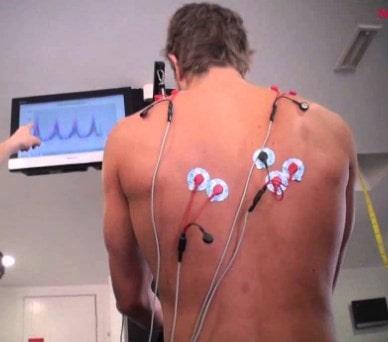 Diagnóstico de la Radiculopatía