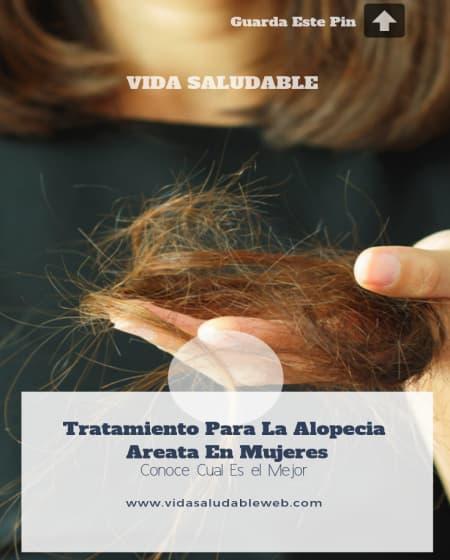 tratamiento para la alopecia areata en mujeres