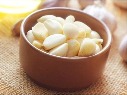 Síntomas de las varices