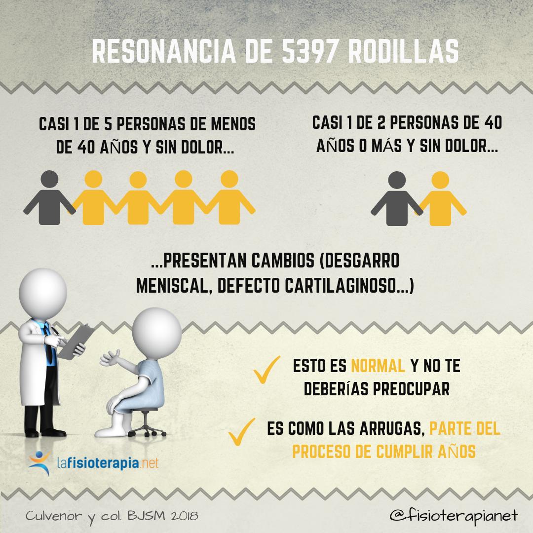 menisco roto sin dolor de rodilla