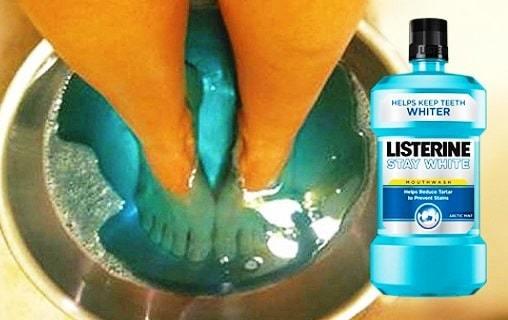 remedios para talones agrietados