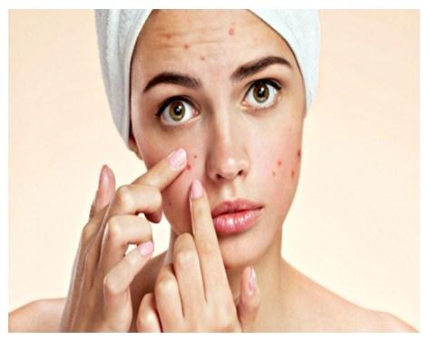 Beneficios de los tratamientos para el acne